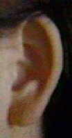 fibrocystic breast ear